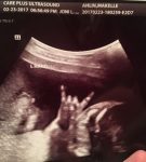 baby-01